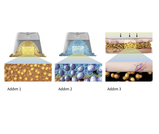 Classys Clatuu Alpha